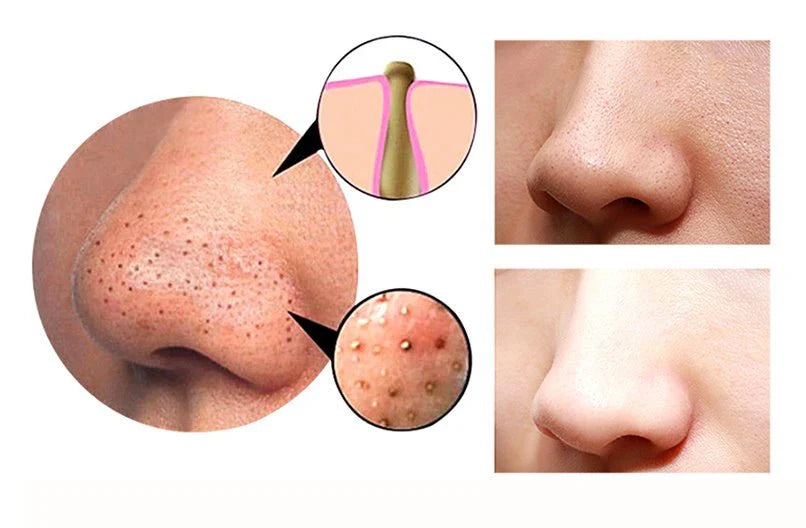 4 in 1 Body Guasha Cupping Blackhead Remover Machine Facial Pore Deep Cleansing Beauty Skin Care 79.00 AED