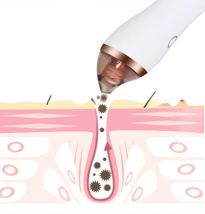 4 in 1 Body Guasha Cupping Blackhead Remover Machine Facial Pore Deep Cleansing Beauty Skin Care 79.00 AED